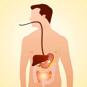 Ulcerative colitis doctor Mumbai
