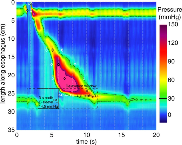 High-Resolution Manometry - Dr. Harshad Joshi