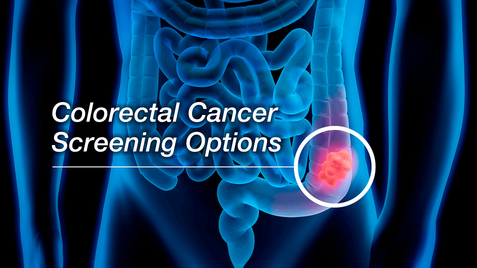 Colon Cancer Screening